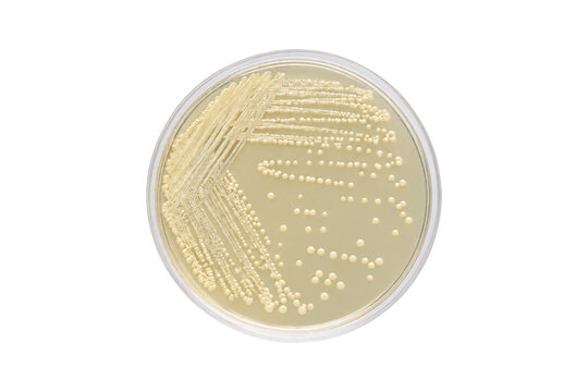 Petri dish with streaked cream-colored bacterial colonies growing on nutrient agar, isolated on a clean white background for microbiology laboratory research, clinical testing, and diagnostic science 