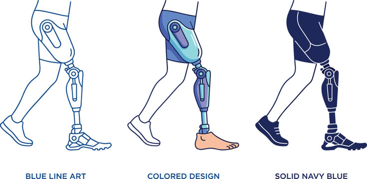 Bionic leg prosthesis vector illustration showing different artistic styles for medical technology orthopedic rehabilitation and disability inclusion