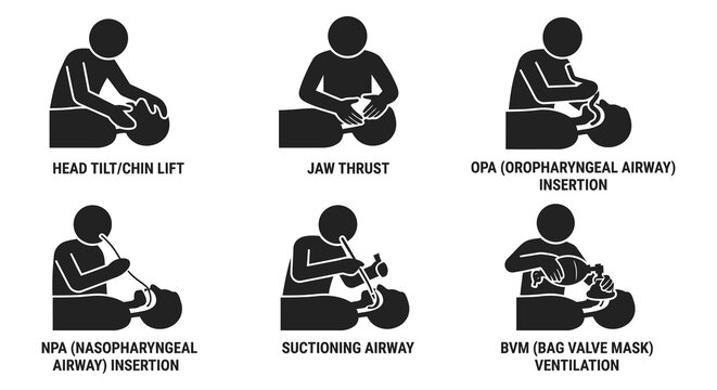 Medical procedure illustrations depict emergency airway management techniques
