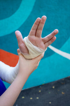Finger exercise while wearing cast on children hand in close-up on colored background. Immobilization of elbow joint with splint
