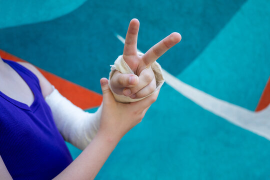 Finger exercise while wearing cast on children hand in close-up on colored background. Immobilization of elbow joint with splint