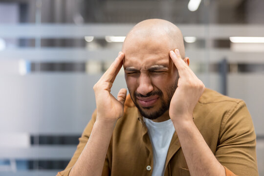 Workplace burnout and stress, man suffering from a migraine or headache in a modern office environment