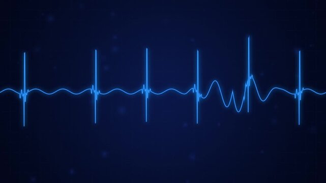 Blue ekg heartbeat monitor pulse line animation loop for medical and healthcare technology presentations