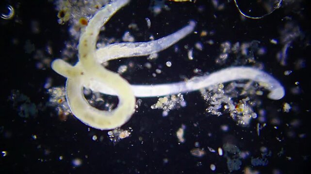 Two intertwined nematode roundworms wriggling in dirty water drop under 40x darkfield microscopy