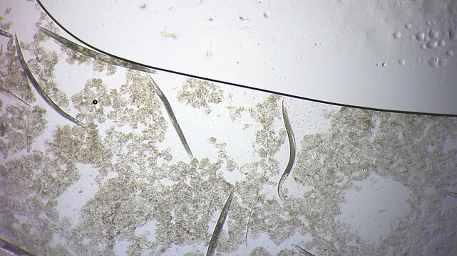 Multiple nematode roundworms moving through organic detritus under 40x brightfield microscopy