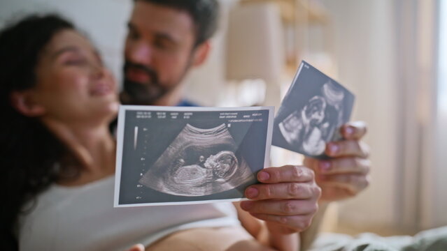 Expecting couple looking sonogram scan photos. Pregnant wife husband embracing