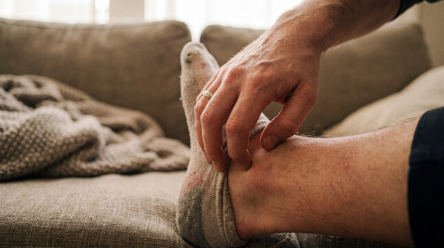 Close-up of a person sitting on a sofa, scratching an inflamed, itchy, and red patch of skin around their ankle while wearing a sock.
