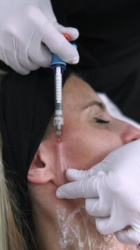 Vertical video. Face injection. Filler therapy. Female professional cosmetician hands in gloves using dermal product for rejuvenation in aesthetic salon.