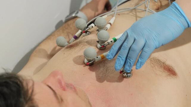 Medical worker removes electrode sensors from man chest after cardiac test. Specialist detaches contact points lifting wires from skin carefully