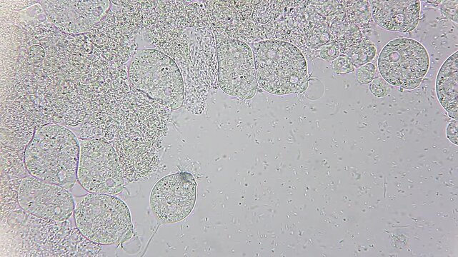 Colony of Vorticella ciliates attached to substrate feeding on bacteria under 400x brightfield microscopy