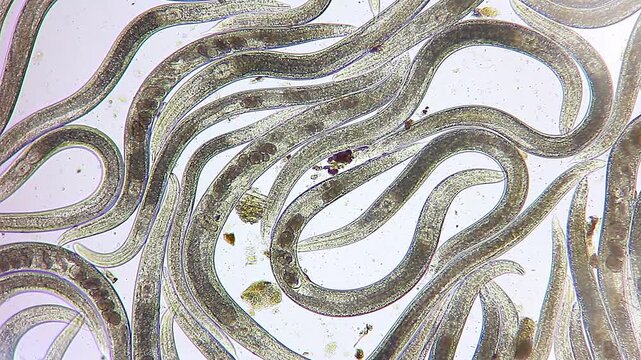 Dense colony of nematode roundworms with internal eggs visible under 100x brightfield microscopy