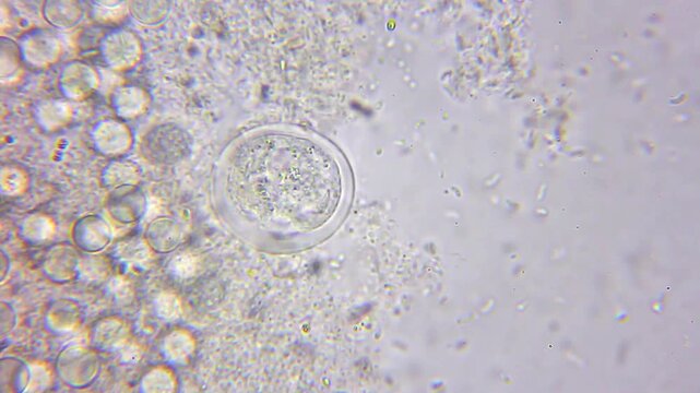 High magnification of ciliate protozoan cyst surrounded by active bacteria under 1000x brightfield microscopy