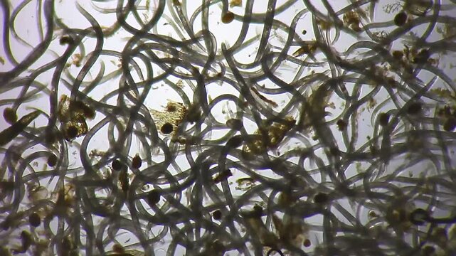 Massive colony of nematode roundworms swarming in a dirty water drop under 40x brightfield microscopy