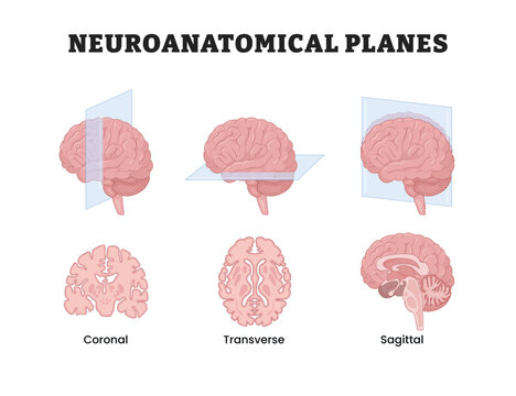 Neuroanatomical planes labeled diagram, educational medical poster design healthcare scheme, coronal transverse and sagittal sections of the human brain. Labeled anatomical brain views