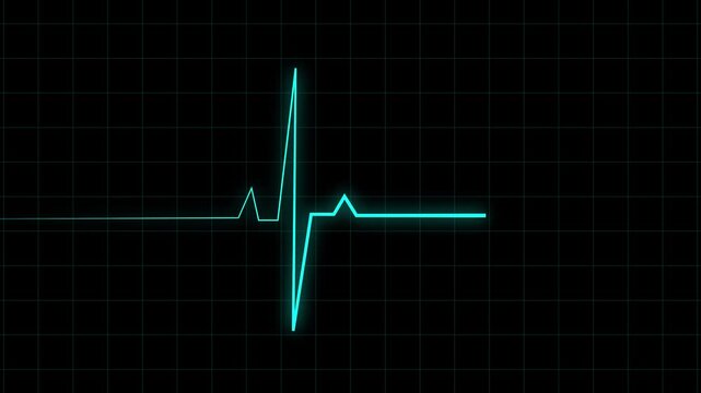 Heartbeat line animation pulses across a black digital grid. Hospital patient pulse telemetry traces on this heartbeat line. Medical cardiology health data guides the heartbeat line.