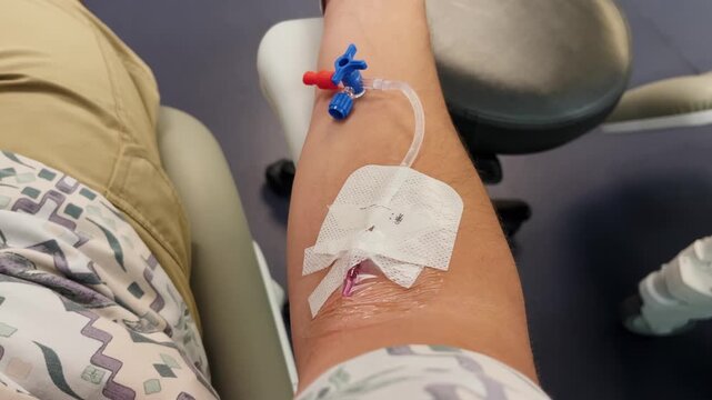 Patient's arm with an IV catheter secured by medical tape, sitting in a hospital chair, medical treatment concept. High quality 4k footage