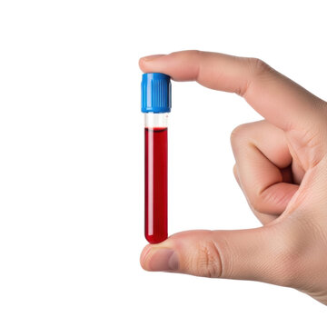 A hand holding a glass blood sample test tube with a blue cap isolated on white background