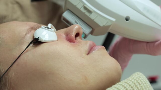 A cosmetology laser applicator moves across a woman's cheek near her nose, treating facial blood vessels and skin imperfections up close