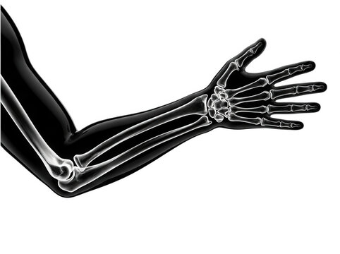 Digital X ray style illustration of human arm bones on transparent background