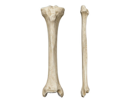 Human tibia and fibula bones isolated on transparent background viewed from multiple anatomical angles for clinical study