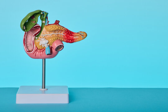 Gastroenterology anatomical model close-up. Diagnostics of duodenal ulcer and pancreatic cancer.