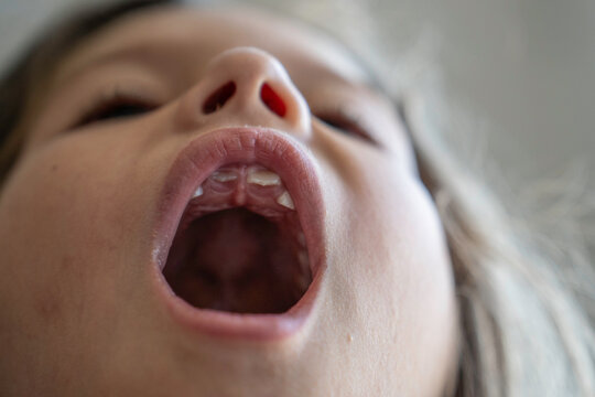 Generation alpha child opens mouth in a close-up view showing developing upper teeth. Detailed low-angle portrait highlights tooth eruption, oral anatomy, and pediatric dental health.