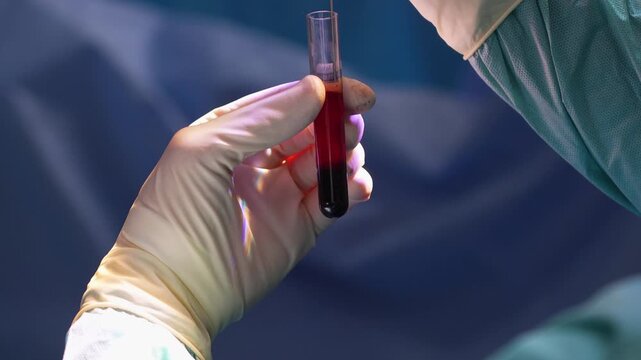 Medical professional in sterile gloves carefully draws blood from a test tube with a syringe in a clinical lab, emphasizing precise technique for diagnostic analysis and research