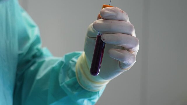 Clinical laboratory scientist wearing sterile gloves injecting a blood sample with a syringe into a vacuum tube for analysis, highlighting the research and diagnostic process in a hospital