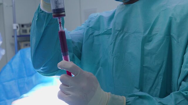 Medical professional in sterile gloves and surgical gown carefully transferring red bone marrow aspirate between two syringes in a modern hospital operating theater before a transplantation procedure