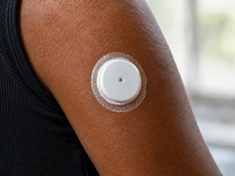 Continuous glucose monitor sensor on the back of a dark-skinned upper arm in natural light