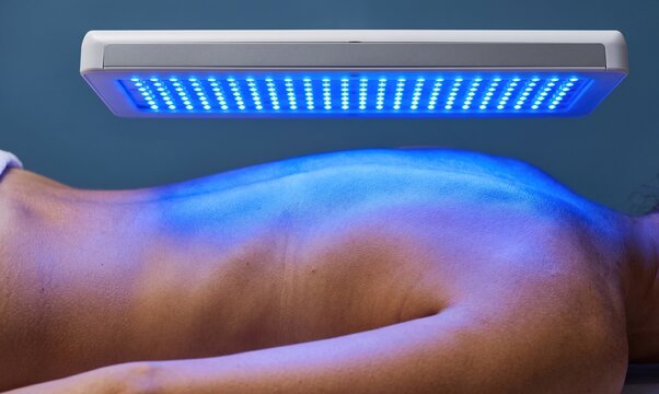 Blue LED light photodynamic therapy for back acne and skin rejuvenation in spa
