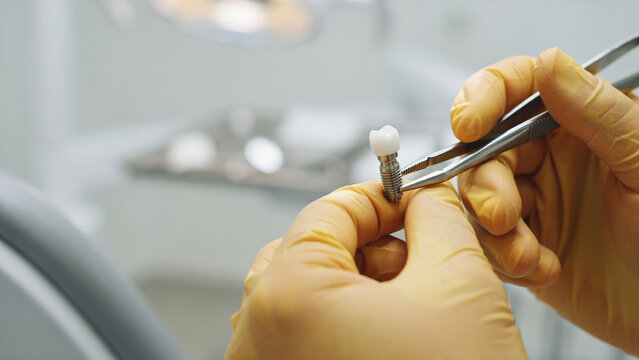 dentist holding dental implant or crown with tweezers in clinic
