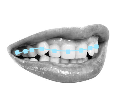 Stylized halftone mouth isolated with light blue sketch brackets