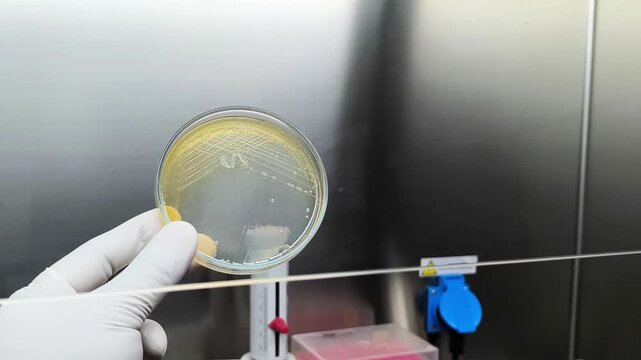 Colony of Burkholderia mallei, a Gram-negative, bipolar aerobic bacterium. B. pseudomallei