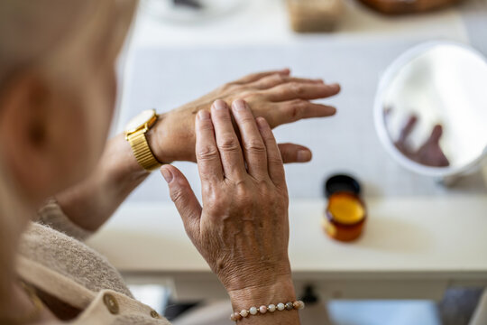 Senior woman applying cream to her hands, close-up
