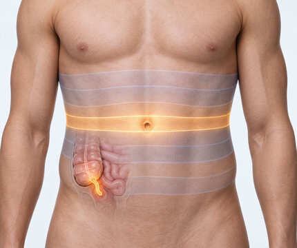 Tenth Thoracic Dermatome and Appendix Pain Illustration