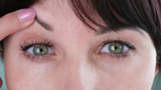 The woman has a drooping eyelid 