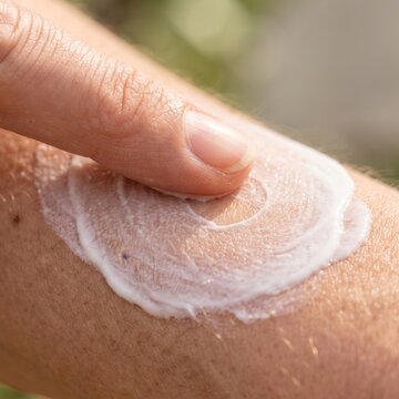 Close-up shot of a finger applying white lotion to tanned skin, with a blurred green background suggesting an outdoor setting.