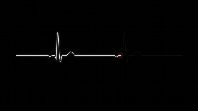 White heartbeat line on black background representing a medical ekg monitor graph showing a steady pulse rhythm for healthcare diagnostic testing and emergency life support 4k Motion Video