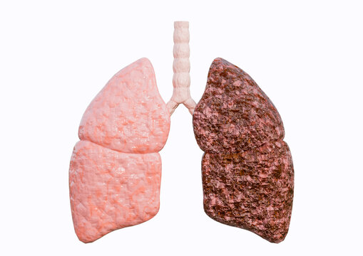 Human lung representing chronic obstructive pulmonary disease COPD , showing both preserved and altered lung tissue, isolated on a white background.