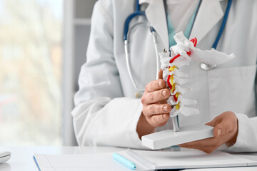 Female doctor with spine model at table in clinic, closeup