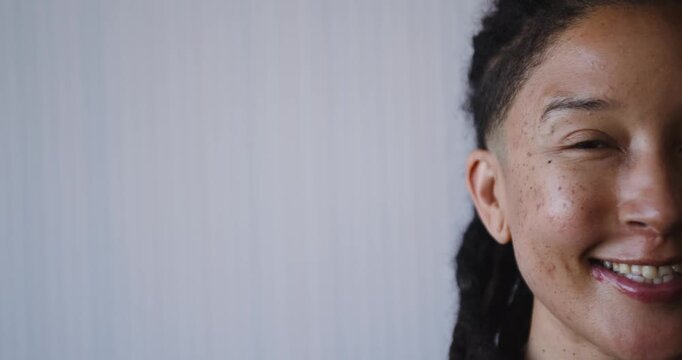 African American nonbinary shifting neutral to laughing by striped wall, freckles braids