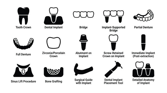 Dental implant procedures illustration with labeled icons isolated on white background