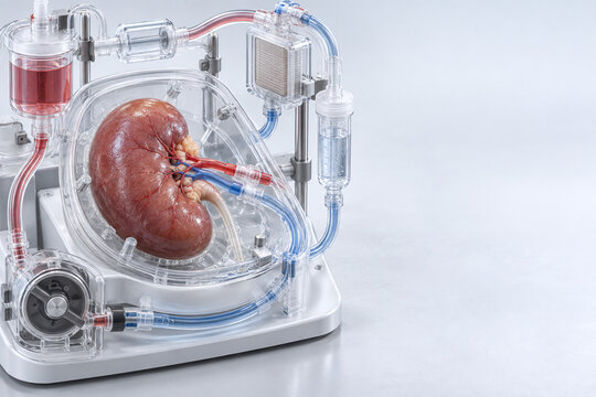 Kidney Preservation in Transparent Perfusion Circuit