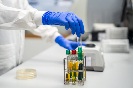 Details of Laboratory Work With Test Tubes and Samples in Science Lab