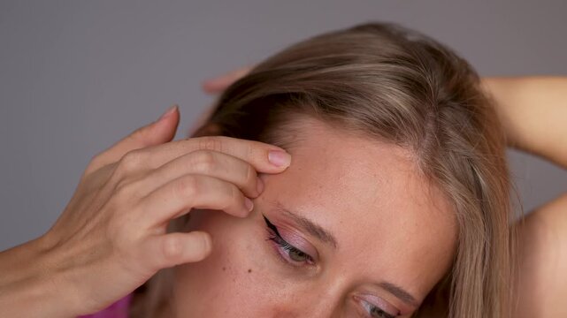 Young woman touches and squeezes pimple on temple, showing acne and skin problem in close-up on grey background