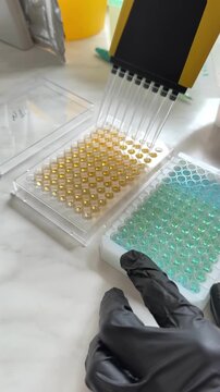Close-up of a laboratory technician in black gloves conducting an Enzyme-linked Immunosorbent Assay (ELISA) test. Using a multichannel pipette to dispense liquid reagents into a 96-well microplate, sh