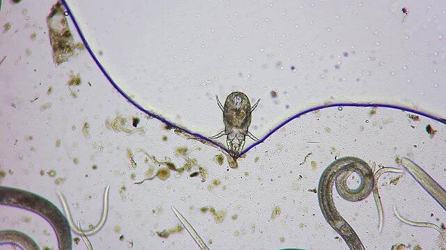 House dust mite near liquid meniscus with moving nematode roundworms under 100x brightfield microscopy