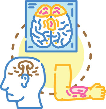 Medical illustration presenting chronic aftermath of trauma affecting the brain - cte - , an injured elbow bone, and osteoporosis bone degeneration, highlighting long term health consequences