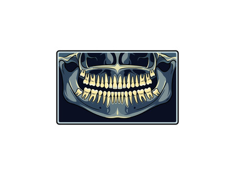 Panoramic Dental X Ray Displaying Upper And Lower Teeth Within The Jaw On A Dark Blue Diagnostic Screen For Orthodontic And Clinical Imaging Vector Illustration